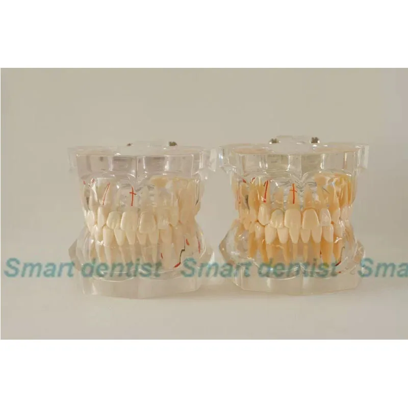 

2016 Transparent Adult Pathology Tooth Model Dental Pathology Teeth Model for Teaching & Communication