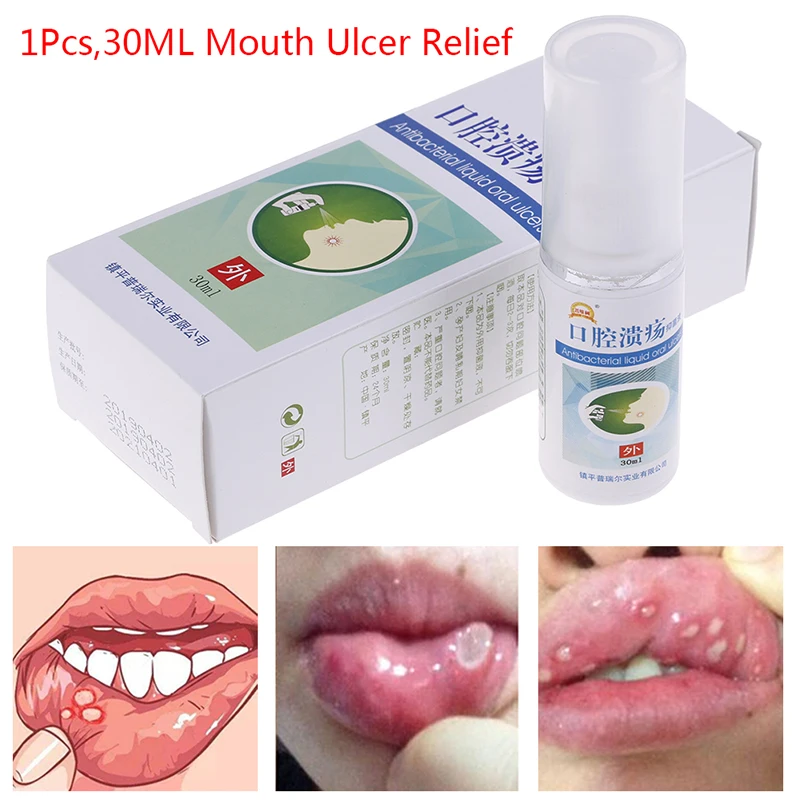 Лечение язва полости рта, глотка, Halitosis, боль в горле, прохладный свежий спрей, облегчение боли, антибактериальный рот, чистый оральный спрей - изображение