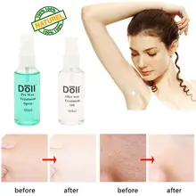 Compare Prices On Hair Spray Wax Shop The Best Value Of Hair