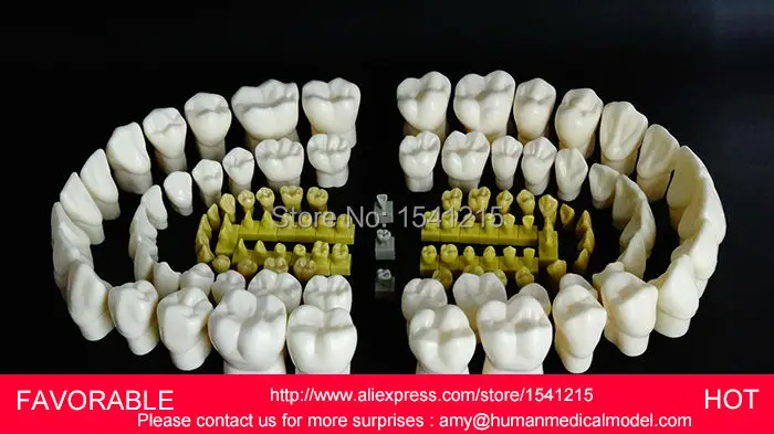 ORAL MODEL,TEETH,MANDIBULAR IMPLANT DENTAL MODEL,NATOMIACL TOOTH ,ORAL CARE MODEL,4 TIMES CROWN DENTAL MODEL-GASEN-DEN032 ORAL MODEL,TEETH,MANDIBULAR IMPLANT DENTAL MODEL,NATOMIACL TOOTH ,ORAL CARE MODEL,4 TIMES CROWN DENTAL MODEL-GASEN-DEN032