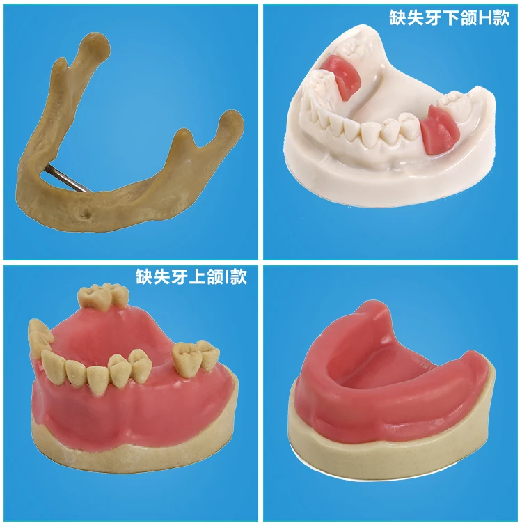 Стоматологические материалы модель орального имплантата хирургические maxillary sinus Стоматологические принадлежности оборудование инструменты мягкие десны