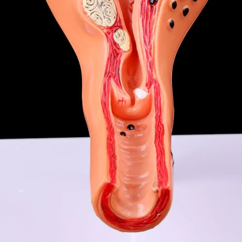 Медицинский реквизит модель почтовая патологическая матка яичник анатомическая модель Анатомия поперечное сечение исследование инструмент