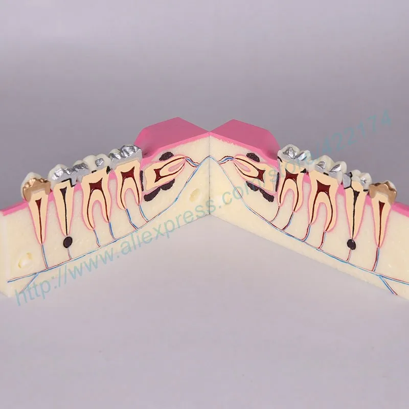 Molar cross section study model 03
