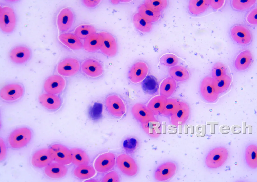 18_Blood_of_frog_smear