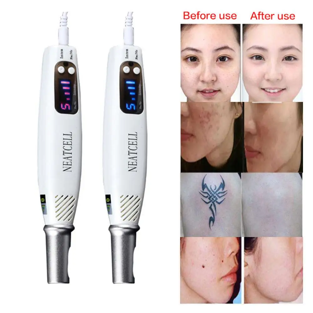 

Professional Tattoo Laser Picosecond Pen Freckle Acne Mole Spot Removal Machine New Well