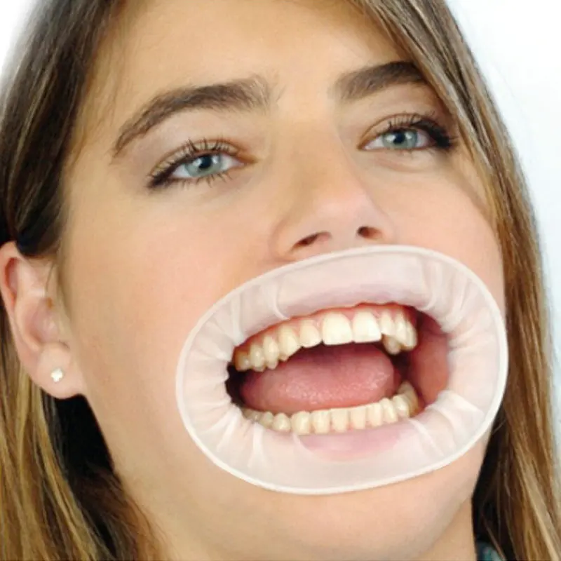 

10 pcs Disposable Dental Rubber Dam Sterile Cheek Retractor Mouth Opener Blue and white color rubber dam for oral cavity