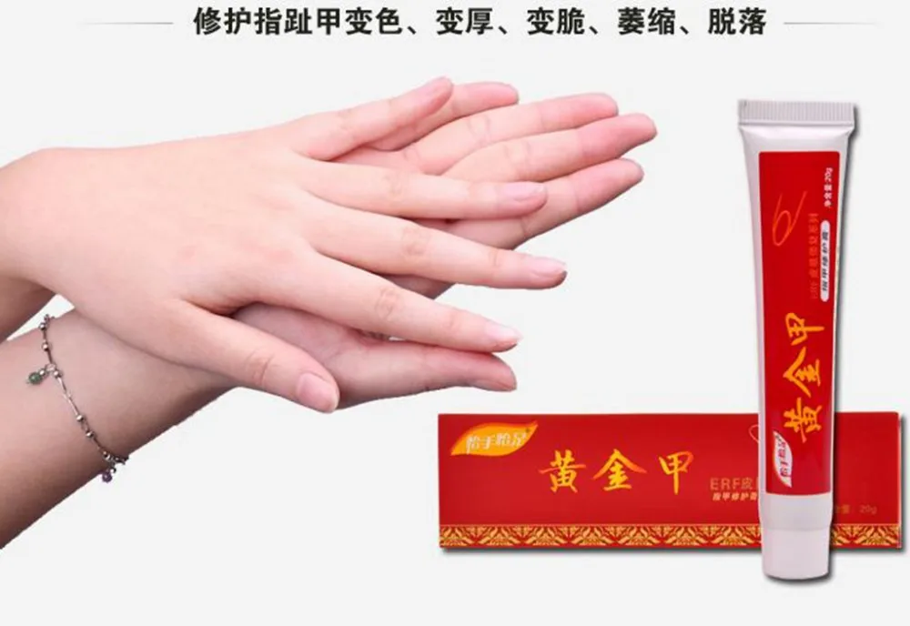 Paronychia лечение онихомикоза ногтей китайские травы противогрибковое предотвращение инфекции грибок ногтей кутикулы смягчение корректор маникюр
