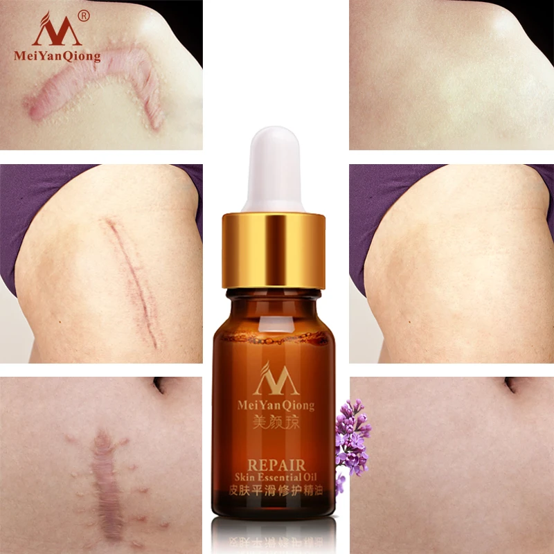 Scar Repair Skin Essential Oil Lavender Essence Skin Care Natural Pure Remove Ance Burn Strentch