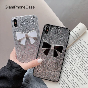 

GlamPhoneCase Cute Glitter Bow Phone Case For iPhone X XS Max XR Soft Silicone Cover For iPhone 7 8 6 6s Plus Case