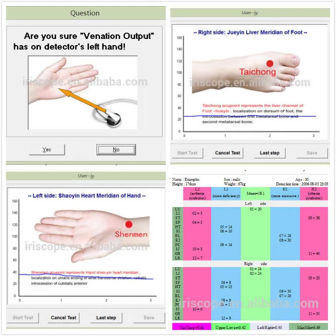 Био здоровья Меридиан обнаружения, китайский Меридиан анализатор системы