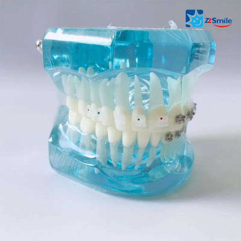 

Dental Teeth Study Model M3003/Orthodontics Model with Metal and Ceramic Bracket