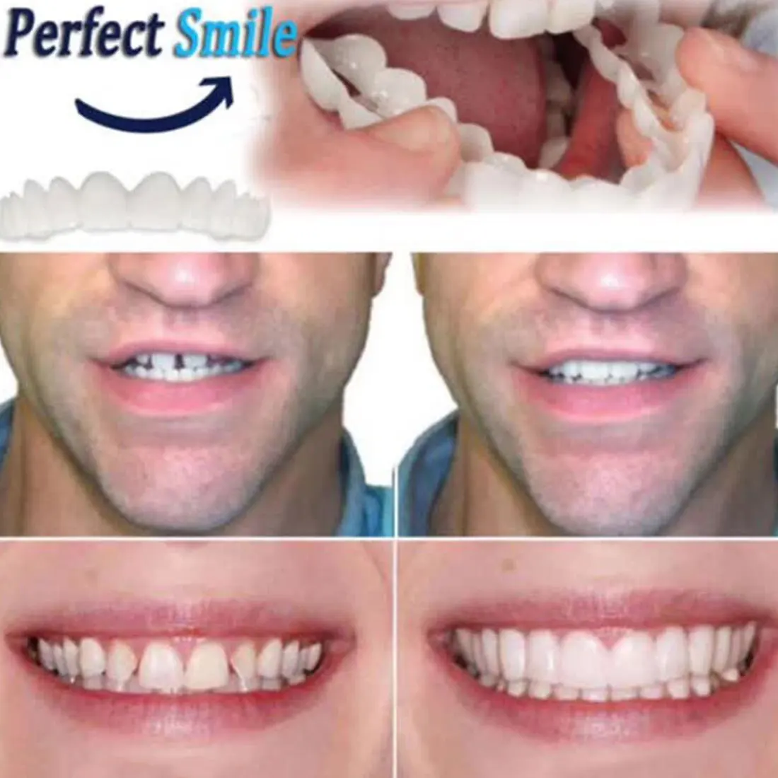 5 шт. зубные протезы Smile Fit Flex косметические зубы удобный шпон покрытие отбеливание зубов оснастки на улыбку зубы косметические зубные протезы