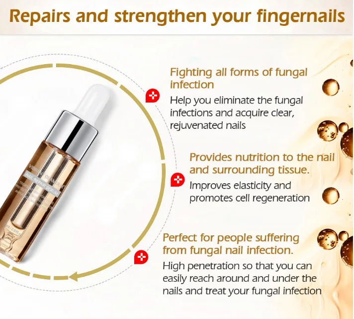Лечение ногтей от грибка Уход за ногами отбеливающая эссенция ног удаление грибка гель анти-инфекция Onychomycosis ногтей восстанавливающая эссенция