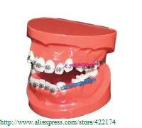 Ортодонтическая пластина для лечебное масло для ногтей исследование модель зубной зуб зубы стоматолог стоматология зубные полоски для tyodont модель