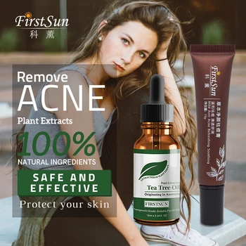 

Herbal Acne Cream Anti Pimple Spot Acne Scars Removal Cream Whitening Beauty Skin Face Care Creams Acne Treament Tea Tree Oil