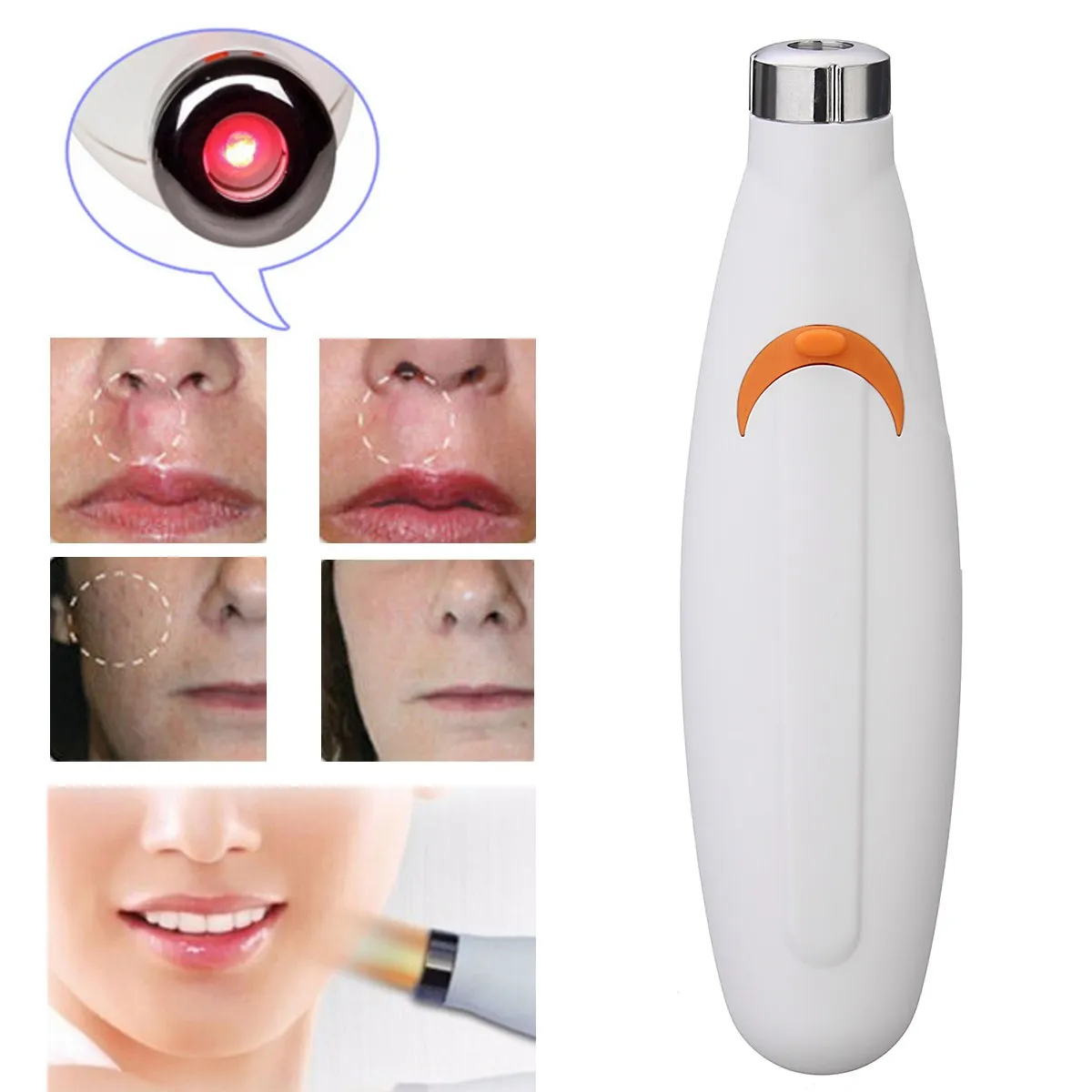 Red Light Therapy Acne Laser Pen Soft Scar Wrinkle Blemish Removal