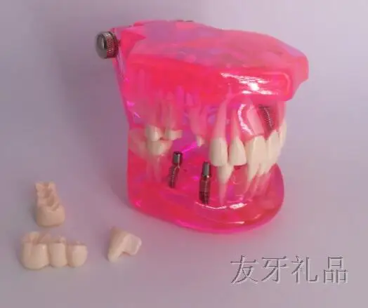 Медицинские товары Зуб модель взрослых прозрачный патологических посадки ремонт модель полости рта модели