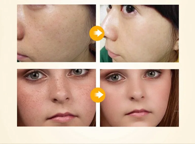 YBL006 face cream 17