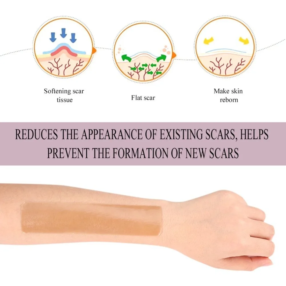 Efficient Surgery Silicone Gel Removal Scar Sheet Therapy Patch 3.5x15cm for Acne Trauma Burn Scar Skin Repair Removel Scar Efficient Surgery Silicone Gel Removal Scar Sheet Therapy Patch 3.5x15cm for Acne Trauma Burn Scar Skin Repair Removel Scar