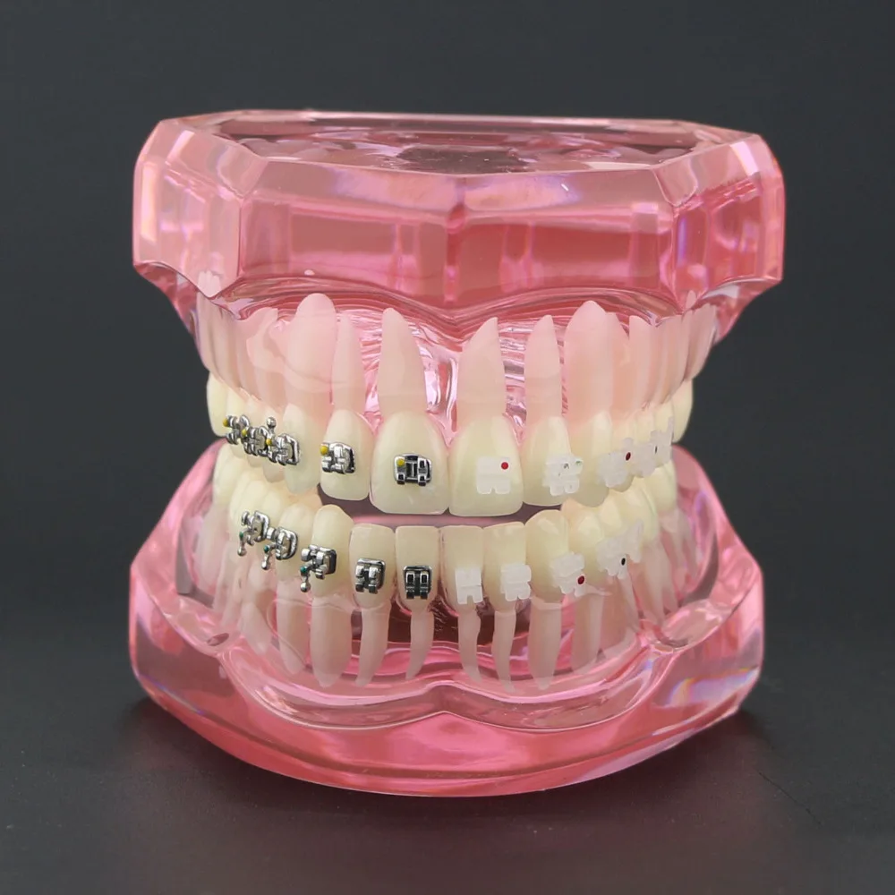 Dental Teeth Study Orthodontic Model with Metal and Ceramic Brackets