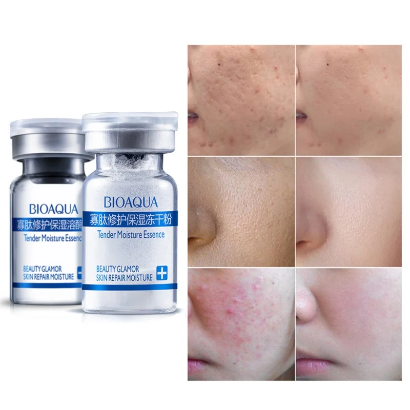 

Repairing Scar Skin Serum Epidermal Growth Removal Acne Removing Essence Skin Care Cream Facial Skin Care