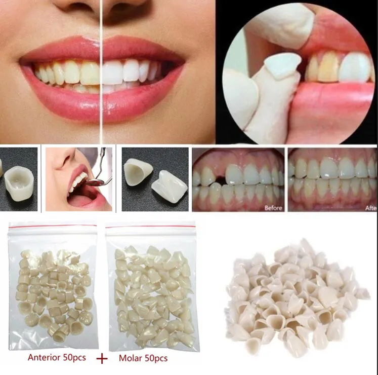 2 упаковки стоматологических материалов смешанные временные короны антериоры Передняя Молярная задняя природа цвет зубной щетки продукты