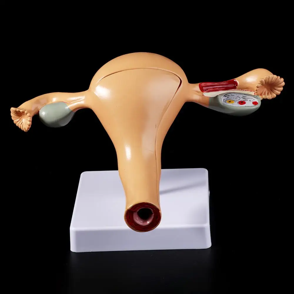 Человека патологическая матки модель яичников анатомические Анатомия болезни патология медицинские очаг для медицинские товары стоматологических