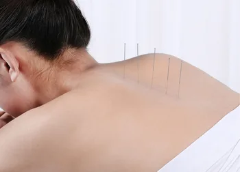 

Sterilze Acupuncture Needle 200 Pcs Disposable Acupuncture Needles Massage Needle With Tube 0.25*13mm