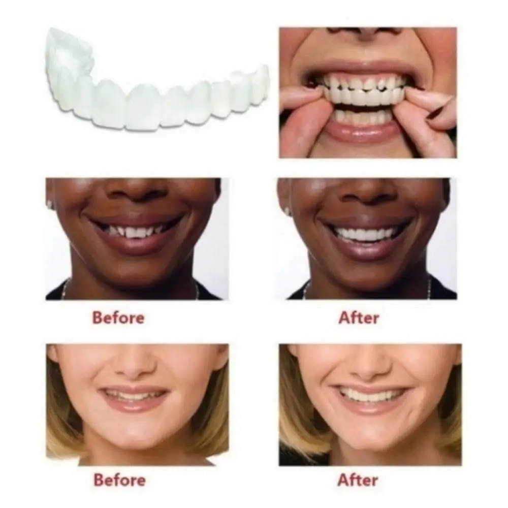 Perfect Smile зубные протезы косметический отбеливающий чехол для имитации зубов