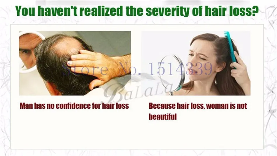 1 шт. Sunburst травяной спрей для волос 60 мл для Fash роста волос алопеция против выпадения волос лечение Сыворотка масло для роста бороды сущность