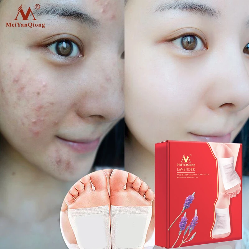 MeiYanQiong 20pcs lot Detox Foot Patches Pads Nourishing Repair Foot Patch Improve Sleep Quality Slimming Patch