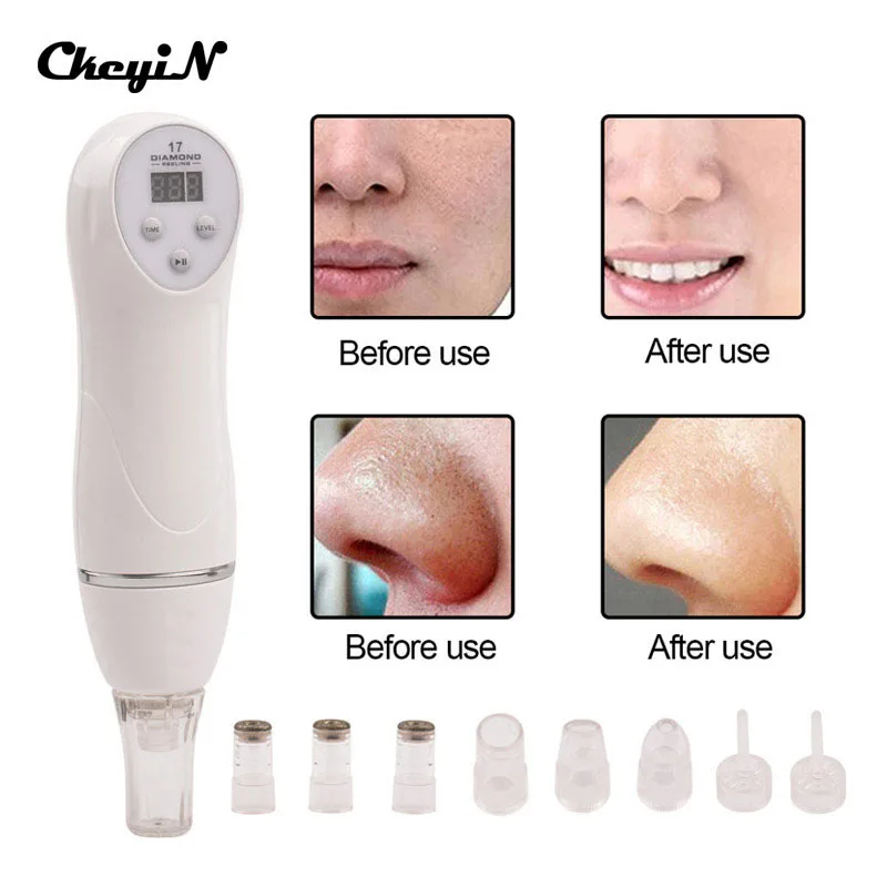 ФОТО 6 Tips Diamond Dermabrasion Peeling Machine Facial Skin Care Massager Beauty Device Skin Care Scars Acne Marks removal clean