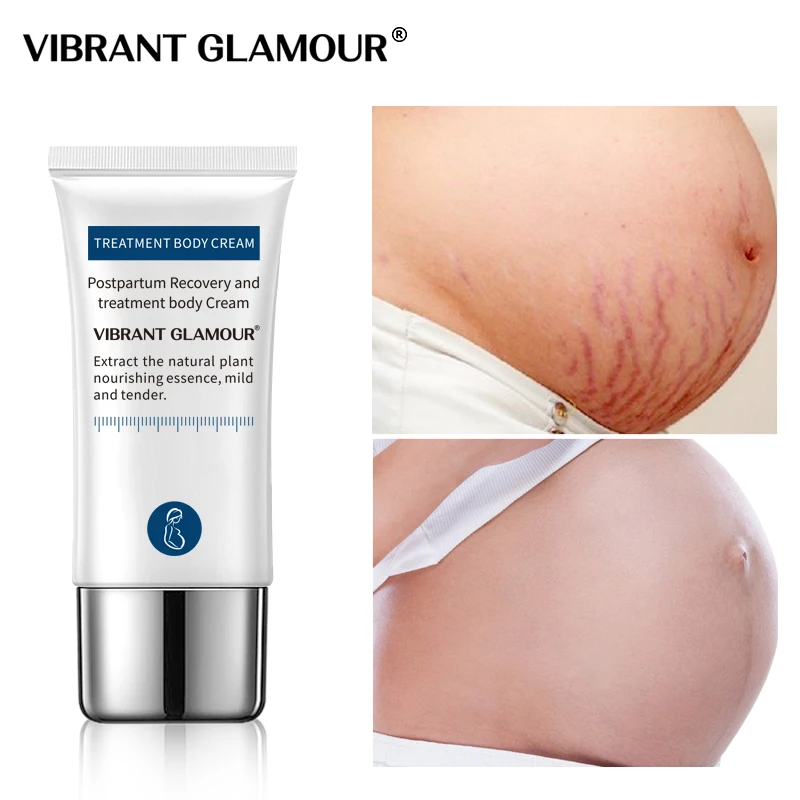 VIBRANT GLAMOUR cocodrilo estiramiento marcas removedor crema cicatrices de embarazo Ance maternidad reparación Anti envejecimiento Winkles reafirmante cuidado corporal