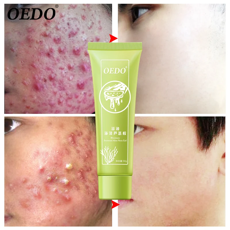 

Seaweed Hydrating Whitening Aloe Vera Gel Day Creams Collagen Anti Aging Acne Wrinkle Whitening Facial Cream Brighten Skin Care