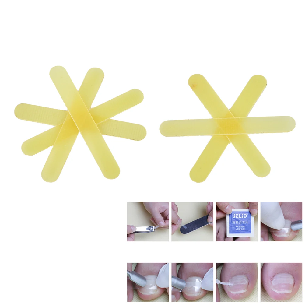 1Pc Ingrown Toe Nail Correction Sticker Patch Paronychia File Acronyx Wire Corrector Foot Care Tool | Красота и здоровье