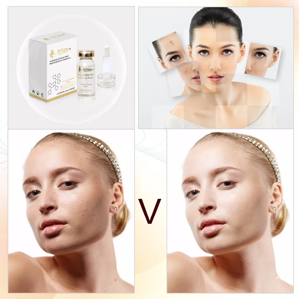 Сыворотка Для Лица Против Акне Beauty Купить
