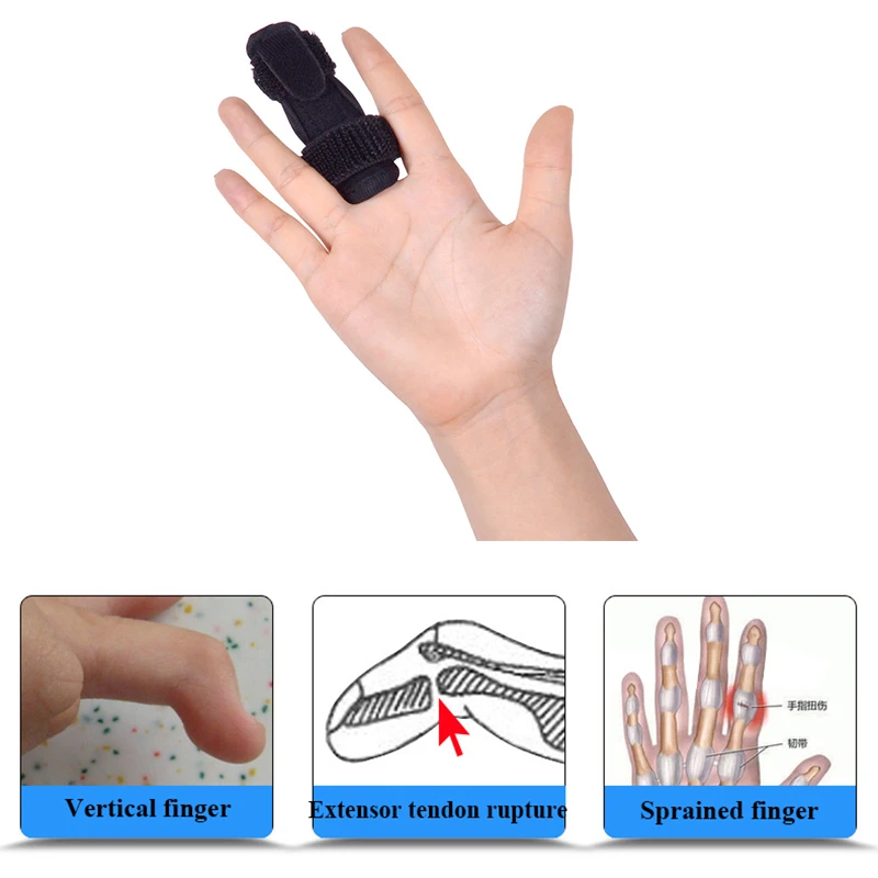 Фиксатор Пальцев Рук Купить В Спб