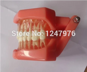 

Tooth extraction model dental teaching model product dental product