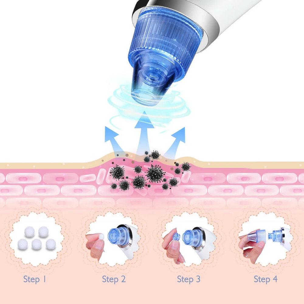 Электронный очиститель для удаления черных точек, вакуумное Очищение лица удаление акне