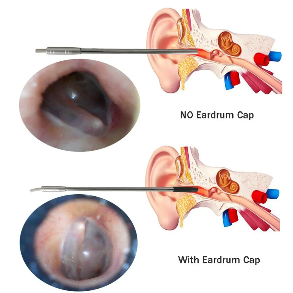4,9 мм беспроводной WiFi медицинский эндоскоп ушной Отоскоп камера Водонепроницаемый эндоскоп камера для Android ПК iphone IOS ушной эндоскоп