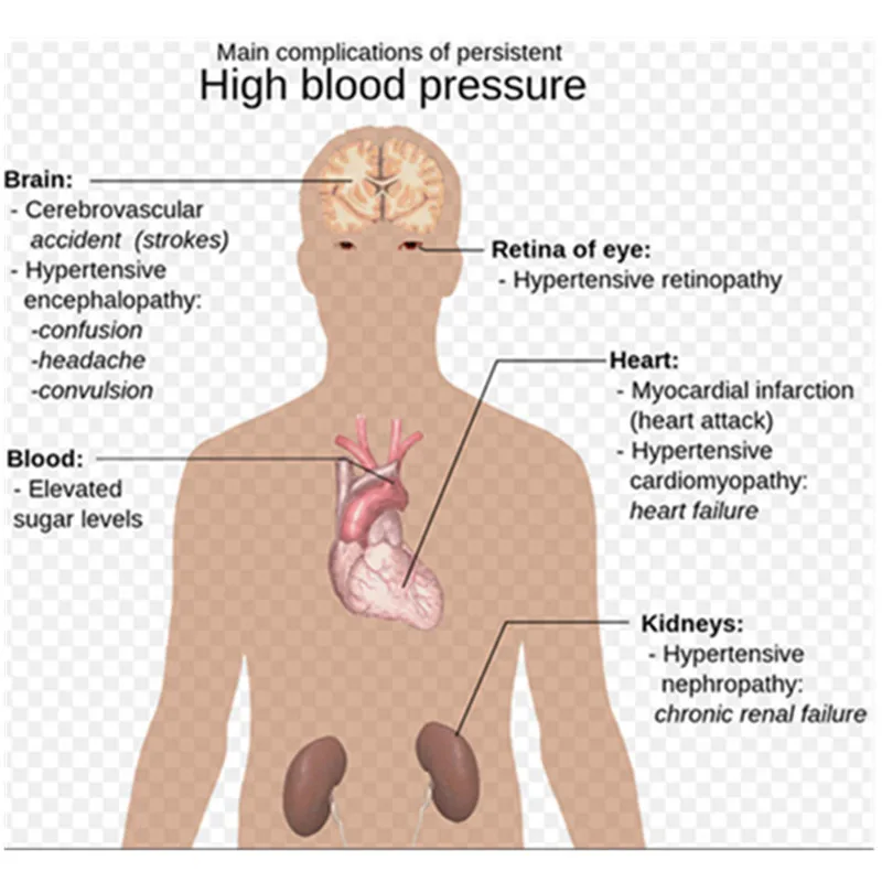 lower blood pressure quickly_