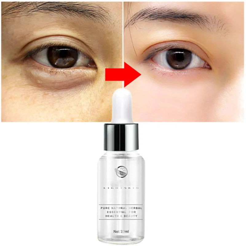 Eyes Care Moisturizing and Soothing Pouch Toning Dark Circles Eye Serum Wrinkle Remover Whitening Repair |