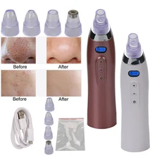 Вакуумный Очиститель пор вакуумное устройство для удаления черных точек отсасывающая машина Comedo микродермабразия лицо поры уход за кожей