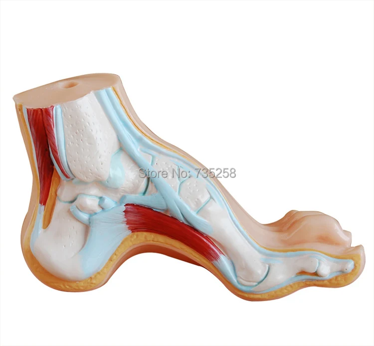 Нормальная стопа, плоскостопие, ножка, нога комбинированная анатомическая модель