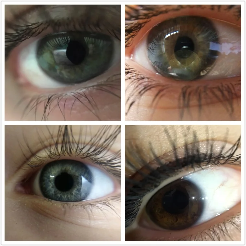 phone lens