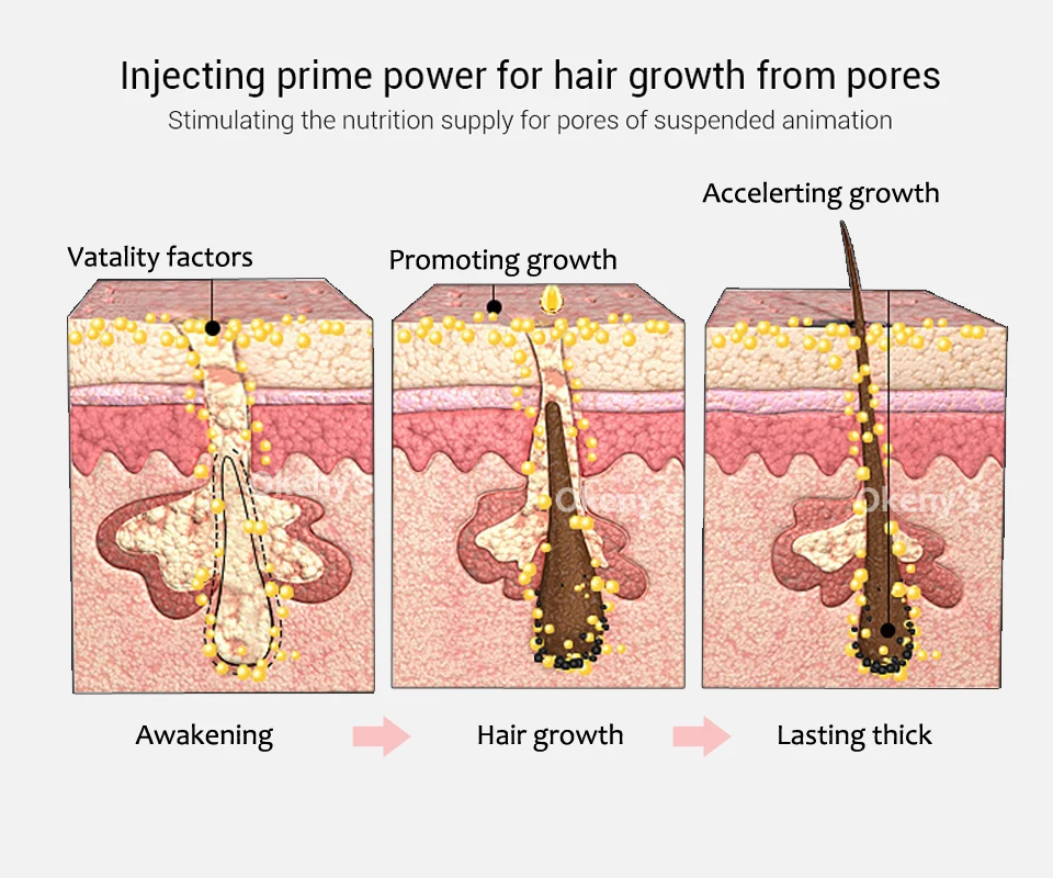 Okeny's Hair Essence спрей масло для роста предотвращающее облысение против выпадения волос уход за волосами питательное увеличение корней волос