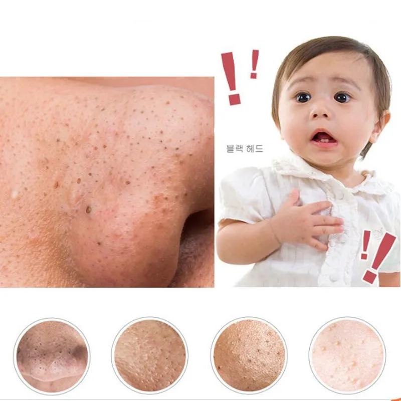 ZD 1Pc Portable Beauty Tool Blackhead Acne Remover Professional Face Skin Deeply Cleaning Tool Mult