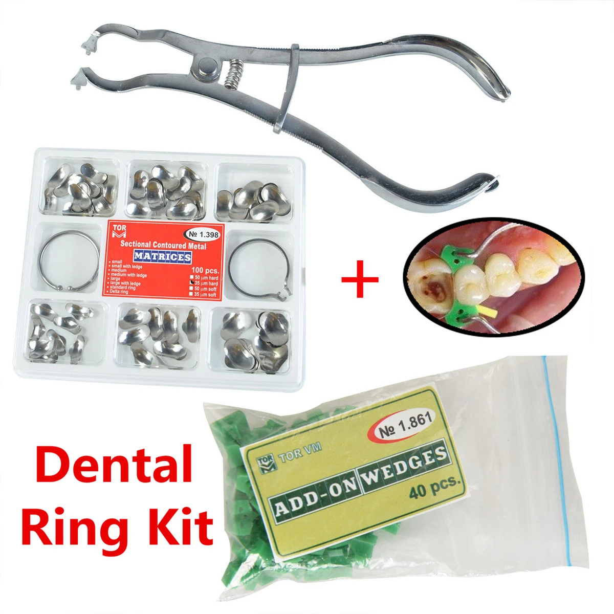 

1 Set?Dental?Ring?Kit Matrixs Sectional Contoured Metal Matrices No.1.398 2 Rings 40pcs Silicone Add- on Wedges Oral Material