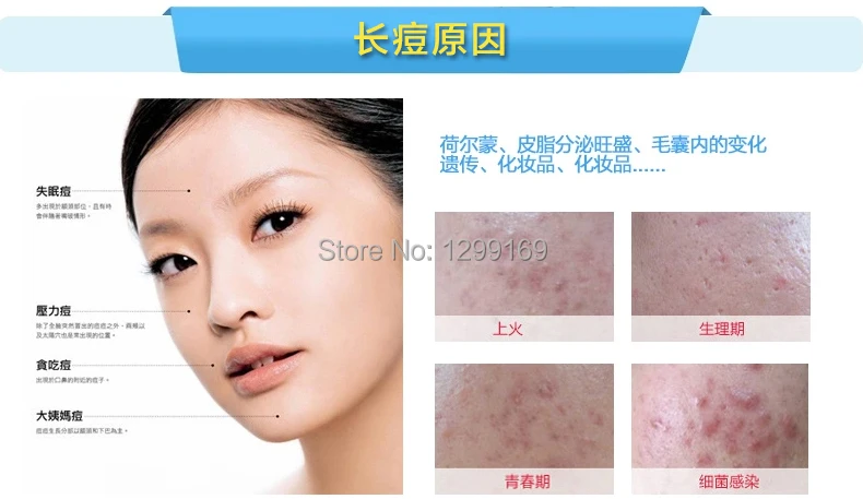 korean eczema cream