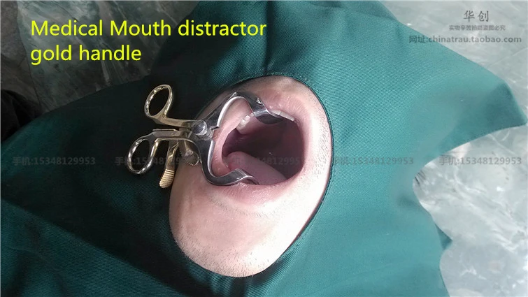 의료 입 distractor 스테인레스 스틸 입 치아 구강 치과 열려있는 드라이버 가정 연습 오픈 입 치경